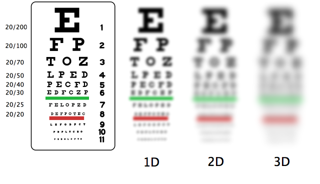 Factors That Go Into Determining Laser Eye Surgery Cost